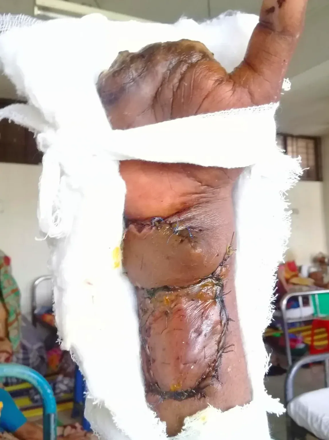 Al Amin - Recovery Journey